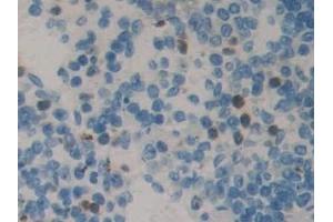 Detection of NME5 in Mouse Spleen Tissue using Polyclonal Antibody to Non Metastatic Cells 5, Protein NM23A Expressed In (NME5) (NME5 antibody  (AA 16-210))