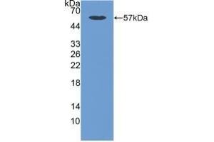 Detection of Recombinant CDHOB, Human using Polyclonal Antibody to Cadherin, Osteoblast (CDHOB) (OB Cadherin antibody  (AA 374-595))