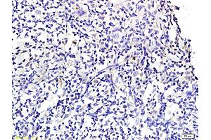 Formalin-fixed and paraffin embedded rat periodontitis tissue labeled with Anti-Wnt3a Polyclonal Antibody , Unconjugated at 1:300 followed by conjugation to the secondary antibody, (SP-0023) , and DAB staining