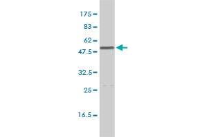 CALR monoclonal antibody (M01), clone 1G11-1A9 Western Blot analysis of CALR expression in K-562 . (Calreticulin antibody  (AA 1-417))