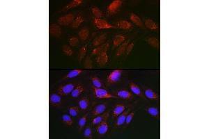 Immunofluorescence analysis of U2OS cells using Cytochrome C Rabbit pAb (ABIN3020718, ABIN3020719, ABIN3020720, ABIN1512803 and ABIN6213689) at dilution of 1:150 (40x lens). (Cytochrome C antibody  (AA 1-105))