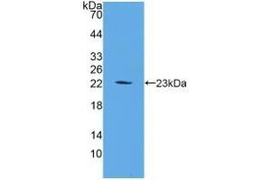 Detection of Recombinant FGF6, Mouse using Polyclonal Antibody to Fibroblast Growth Factor 6 (FGF6) (FGF6 antibody  (AA 39-208))