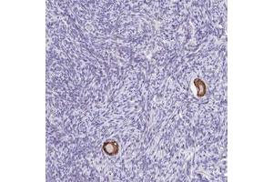 Immunohistochemical staining (Formalin-fixed paraffin-embedded sections) of human ovary with TGM3 polyclonal antibody  shows strong cytoplasmic positivity in follicle cells at 1:200-1:500 dilution. (TGM3 antibody)