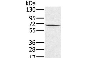 Western Blot analysis of Hela cell using HSF2 Polyclonal Antibody at dilution of 1:550 (HSF2 antibody)