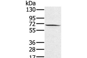 Western Blot analysis of Hela cell using HSF2 Polyclonal Antibody at dilution of 1:550