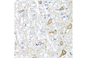 Immunohistochemistry of paraffin-embedded rat brain using SERPINA7 antibody (ABIN5975019) at dilution of 1/100 (40x lens).