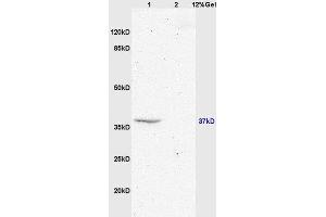 Lane 1: mouse brain lysates Lane 2: mouse embryo lysates probed with Anti GPR55 Polyclonal Antibody, Unconjugated  at 1:200 in 4˚C. (GPR55 antibody  (AA 141-240))