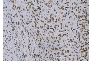 IHC analysis of Gpnmb using anti-Gpnmb antibody (ABIN7600217). (Osteoactivin antibody  (AA 164-564))