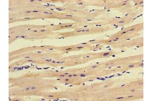 Immunohistochemistry of paraffin-embedded human heart tissue using ABIN7166097 at dilution of 1:100
