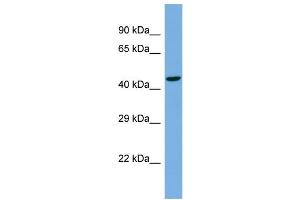 Host:  Rabbit  Target Name:  TBC1D22A  Sample Type:  NCI-H226 Whole cell lysates  Antibody Dilution:  1. (TBC1D22A antibody  (Middle Region))