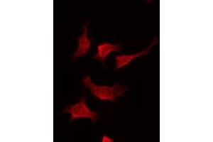 ABIN6275016 staining Hela by IF/ICC. (Claudin 19 antibody  (Internal Region))