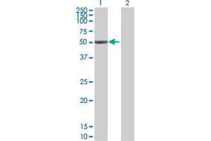 Western Blot analysis of ALDH1A1 expression in transfected 293T cell line by ALDH1A1 MaxPab polyclonal antibody. (ALDH1A1 antibody  (AA 1-501))