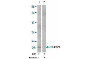 Western blot analysis of extracts from MDA-MB-435 cells untreated or EGF-treated (200 ng/mL, 30 min) using EIF4EBP1 polyclonal antibody . (eIF4EBP1 antibody)
