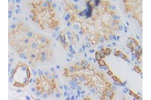 Detection of CYFRA21-1 in Human Kidney Tissue using Polyclonal Antibody to Cytokeratin Fragment Antigen 21-1 (CYFRA21-1) (CYFRA21.1 antibody  (AA 244-400))