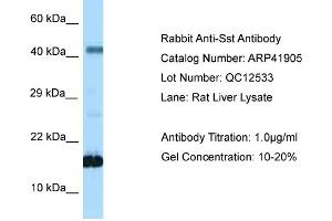 Host: Rabbit Target Name: SST Sample Tissue: Rat Liver Antibody Dilution: 1ug/ml (Somatostatin antibody  (N-Term))