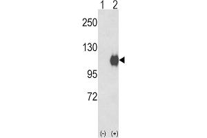 Western Blotting (WB) image for anti-Ectonucleotide Pyrophosphatase/phosphodiesterase 2 (ENPP2) antibody (ABIN2927789) (ENPP2 antibody)