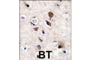 Formalin-fixed and paraffin-embedded human brain tissue reacted with PKC gamma antibody , which was peroxidase-conjugated to the secondary antibody, followed by DAB staining.
