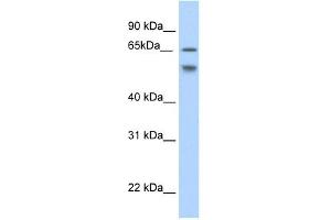 Western Blot showing RBM35B antibody used at a concentration of 1-2 ug/ml to detect its target protein. (ESRP2 antibody  (N-Term))