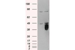 Western Blotting (WB) image for anti-Tissue Factor Pathway Inhibitor (Lipoprotein-Associated Coagulation Inhibitor) (TFPI) (C-Term) antibody (ABIN2465317) (TFPI antibody  (C-Term))