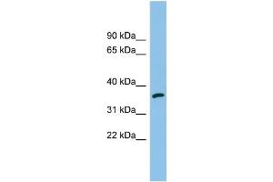 WB Suggested Anti-AKR1C2 Antibody Titration: 0.