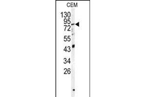 Western blot analysis of PSS1 antibody (N-term K9) (ABIN1882107 and ABIN2839313) in CEM cell line lysates (35 μg/lane). (PAPSS1 antibody  (N-Term))