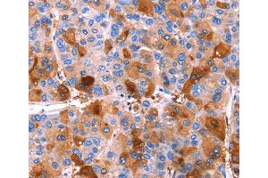 Immunohistochemistry (IHC) image for anti-Endoplasmic Reticulum To Nucleus Signaling 2 (ERN2) antibody (ABIN2434605) (ERN2 antibody)