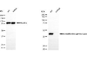 Western blotting analysis using cystathionine gamma-lyase antibody (ABIN7798232). (CTH antibody)