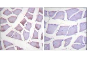 Immunohistochemistry (IHC) image for anti-X-Linked Inhibitor of Apoptosis (XIAP) (AA 53-102) antibody (ABIN2888718) (XIAP antibody  (AA 53-102))