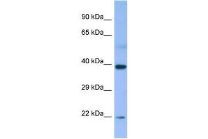 WB Suggested Anti-MBIP Antibody Titration: 1. (MBIP antibody  (N-Term))