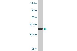 Western Blot detection against Immunogen (37. (NEK5 antibody  (AA 601-708))