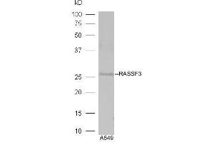 Lane 1:A549 lysates probed with Rabbit Anti-RASSF3 Polyclonal Antibody, Unconjugated  at 1:5000 for 90 min at 37˚C. (RASSF3 antibody  (AA 51-150))