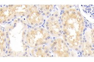 Detection of PARK7 in Human Kidney Tissue using Polyclonal Antibody to Parkinson Disease Protein 7 (PARK7) (PARK7/DJ1 antibody  (AA 1-189))