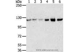 Western blot analysis of 823, A549, K562, 293T, hepg2 and huvec cell, using RBM5 Polyclonal Antibody at dilution of 1:450