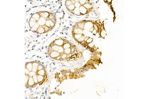 Immunohistochemistry of paraffin-embedded human colon using Cytokeratin 19 (KRT19) Rabbit pAb (ABIN3020778, ABIN3020779, ABIN3020780 and ABIN6213719) at dilution of 1:50 (40x lens). (Cytokeratin 19 antibody  (AA 241-400))