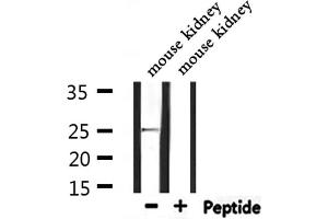 Western blot analysis of extracts from mouse kidney, using RAB32 Antibody. (RAB32 antibody  (C-Term))