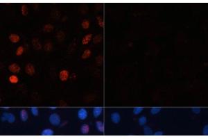 Immunofluorescence analysis of C6 cells using Phospho-γH2A. (gamma H2AX antibody  (pSer139))