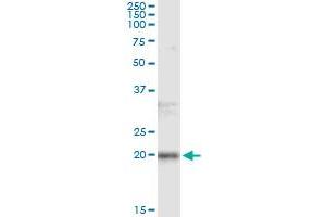 Immunoprecipitation of FTL transfected lysate using anti-FTL monoclonal antibody and Protein A Magnetic Bead , and immunoblotted with FTL MaxPab rabbit polyclonal antibody. (FTL antibody)