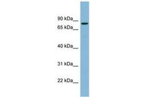anti-Erythrocyte Membrane Protein Band 4.1 (Elliptocytosis 1, RH-Linked) (EPB41) (AA 107-156) antibody