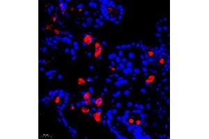 Immunofluorescence of paraffin embedded mouse breast using Calcitonin (ABIN7073271) at dilution of 1:650 (400x lens) (Calcitonin antibody)