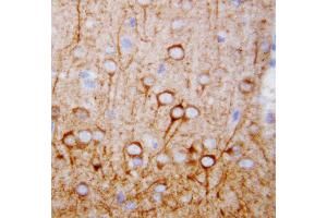 Anti-CaMKK antibody, IHC(P) IHC(P): Rat Brain Tissue