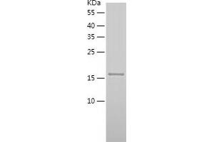 Western Blotting (WB) image for Tumor Necrosis Factor (Ligand) Superfamily, Member 15 (TNFSF15) (AA 72-251) protein (His tag) (ABIN7125531)