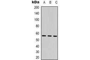 Western blot analysis of SESN1 expression in K562 (A), Hela (B), rat muscle (C) whole cell lysates.