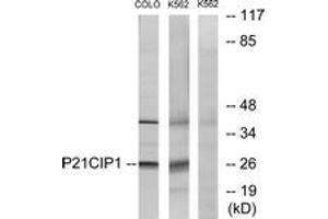 Western blot analysis of extracts from COLO/K562 cells, treated with EGF, using p21 Cip1 (Ab-145) Antibody. (p21 antibody  (AA 111-160))