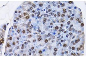 Immunohistochemistry of paraffin-embedded Mouse pancreas using ID3 Polyclonal Antibody at dilution of 1:200 (40x lens). (ID3 antibody)