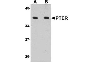 Western Blotting (WB) image for anti-Phosphotriesterase Related (PTER) (C-Term) antibody (ABIN1030607)