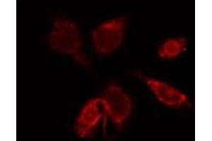 ABIN6274000 staining HepG2 by IF/ICC. (CCR9 antibody  (C-Term))