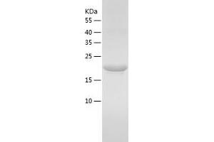 Western Blotting (WB) image for Major Urinary Protein 20 (MUP20) (AA 20-181) protein (His tag) (ABIN7123831)