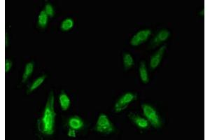 Immunofluorescent analysis of Hela cells using ABIN7155905 at dilution of 1:100 and Alexa Fluor 488-congugated AffiniPure Goat Anti-Rabbit IgG(H+L) (LIPE antibody  (AA 1-251))