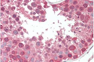ABIN308445 (5µg/ml) staining of paraffin embedded Human Testis. (COG7 antibody  (Internal Region))