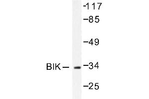 Image no. 1 for anti-BCL2-Interacting Killer (Apoptosis-Inducing) (BIK) antibody (ABIN265329) (BIK antibody)